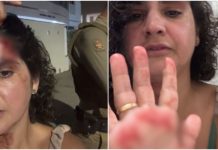 Justiça decreta prisão preventiva de homem acusado de agredir vizinha em condomínio de SC