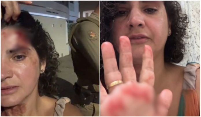 Justiça decreta prisão preventiva de homem acusado de agredir vizinha em condomínio de SC