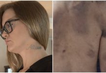 Mulher relata rotina de terror e controle após ser mantida em cárcere por companheiro em Itapema