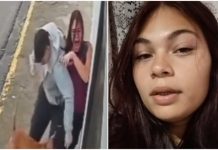 Pitbull envolvido em dois ataques em menos de 48 horas deixa jovem ferida em Imbituba
