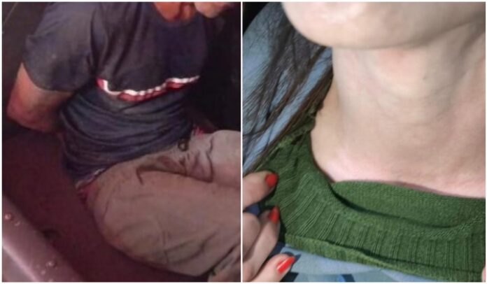 Mulher pede socorro durante ataque e escapa de tentativa de feminicídio em SC